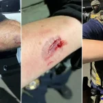 Anti-ICE Agitator Accused of Biting Officers Amidst Delaney Hall Confrontation