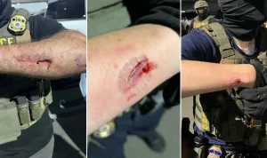 Anti-ICE Agitator Accused of Biting Officers Amidst Delaney Hall Confrontation