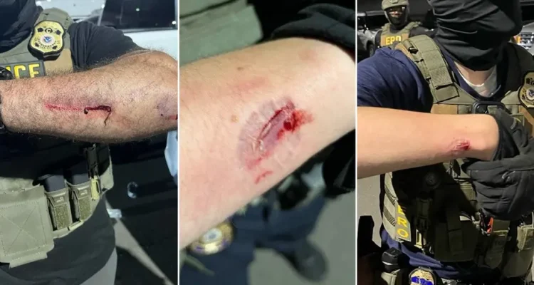 Anti-ICE Agitator Accused of Biting Officers Amidst Delaney Hall Confrontation