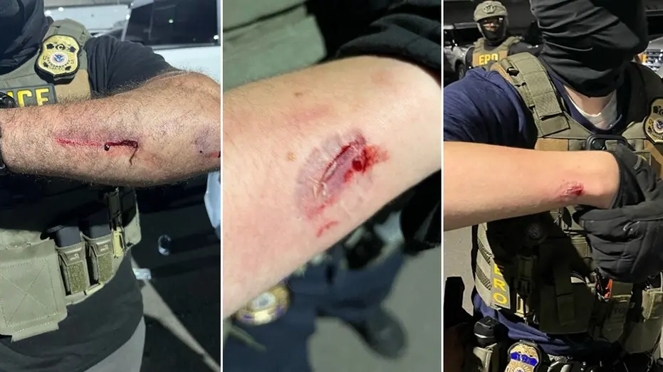 Anti-ICE Agitator Accused of Biting Officers Amidst Delaney Hall Confrontation