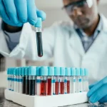 Blood Age May Predict Dementia Risk, New Study Finds