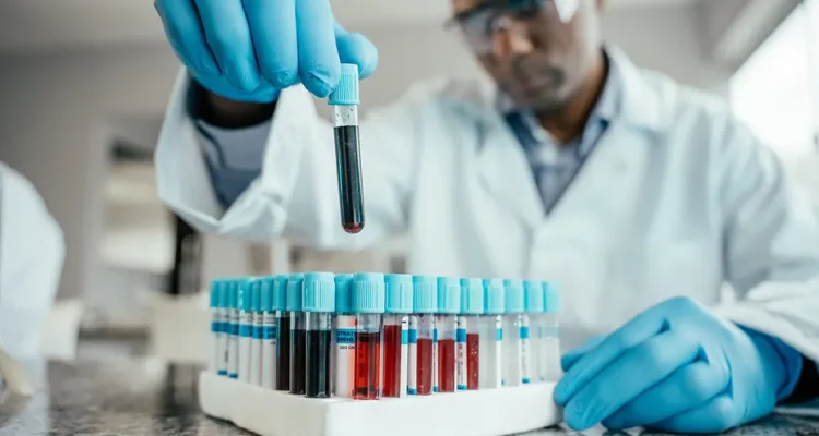 Blood Age May Predict Dementia Risk, New Study Finds