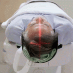 Longevity Gene" May Shield Brain From Alzheimer's Through DNA Repair