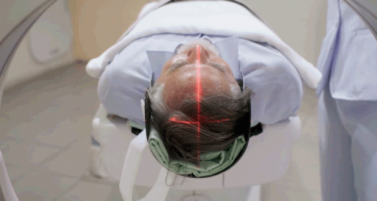 Longevity Gene" May Shield Brain From Alzheimer's Through DNA Repair