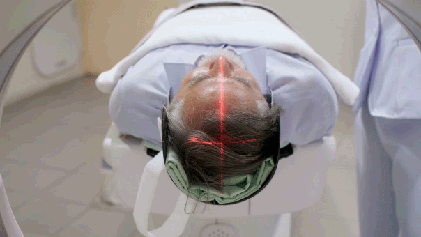 Longevity Gene" May Shield Brain From Alzheimer's Through DNA Repair