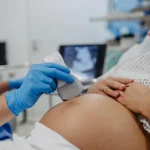 Billing Change May Increase Pregnancy Costs