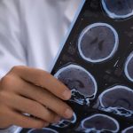 Doctors Mistake Brain Cancer for Live Tapeworms