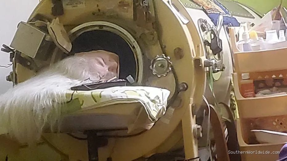 Last American to use an iron lung dies at 78 years old after childhood polio diagnosis