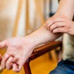 Why Mosquito Bites Itch More When Scratched, Explained by Science