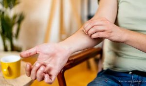 Why Mosquito Bites Itch More When Scratched, Explained by Science