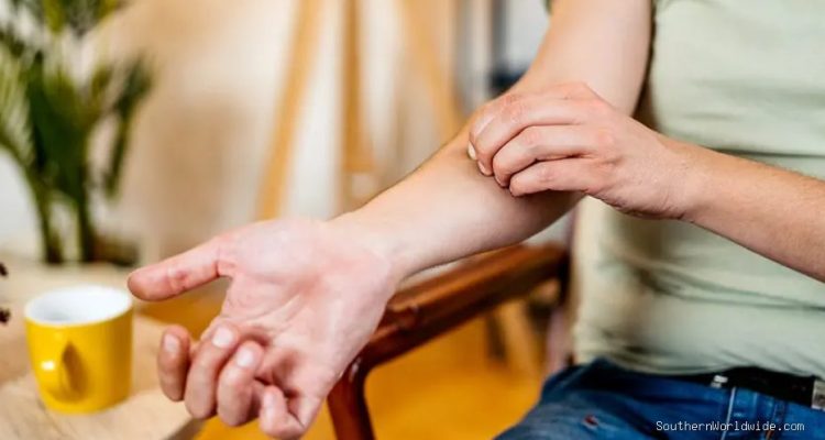 Why Mosquito Bites Itch More When Scratched, Explained by Science
